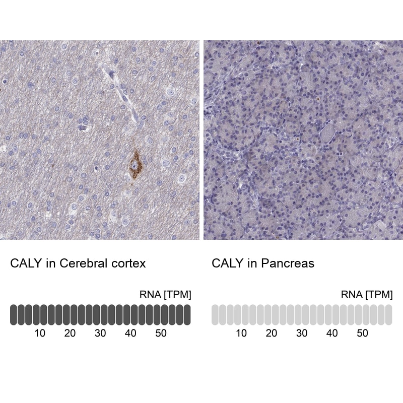 CALY Antibody - BSA Free Immunohistochemistry: CALY Antibody - BSA Free [NBP1-91225]