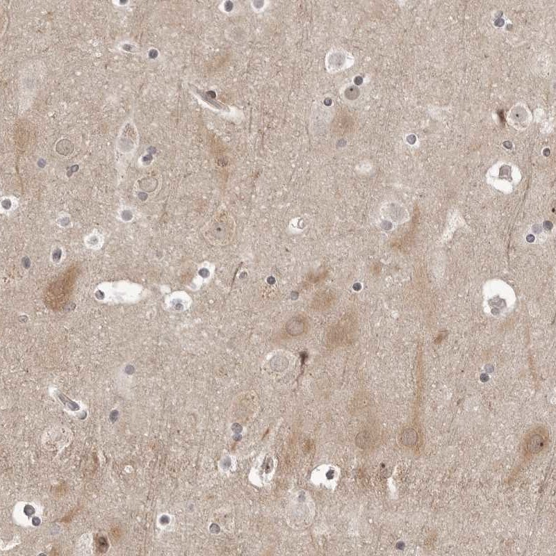 PYK2/FAK2 Antibody - BSA Free Immunohistochemistry-Paraffin: PYK2/FAK2 Antibody [NBP1-91227]