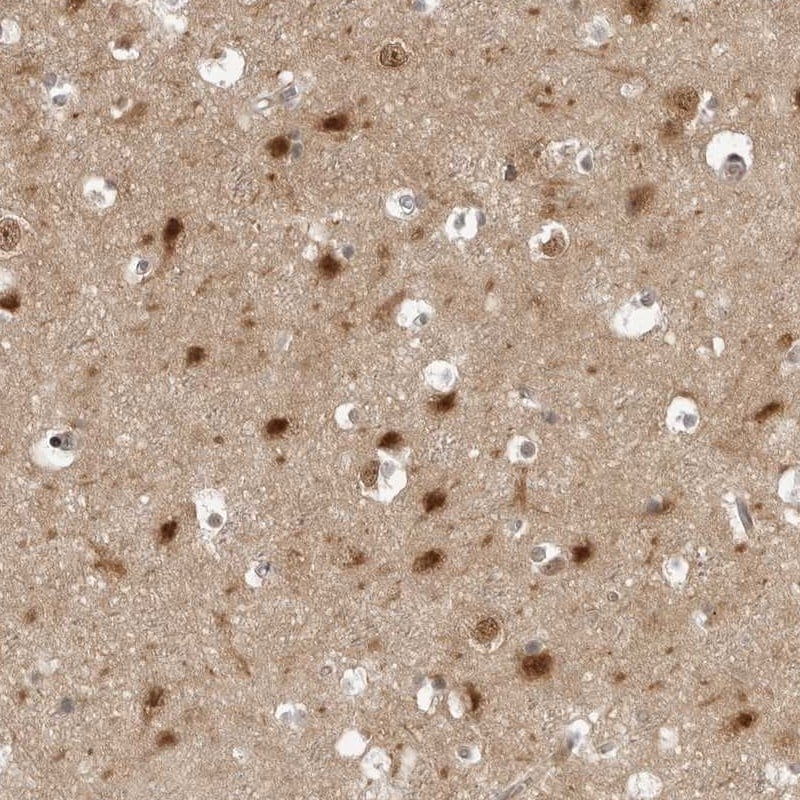 PYK2/FAK2 Antibody - BSA Free Immunohistochemistry-Paraffin: PYK2/FAK2 Antibody [NBP1-91228]