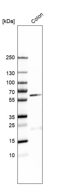 B4GALNT2 Antibody - BSA Free Western Blot: B4GALNT2 Antibody - BSA Free [NBP1-91229]