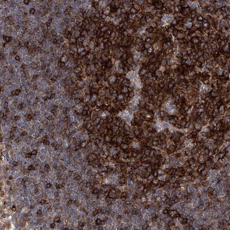 FAM167A Antibody - BSA Free Immunohistochemistry-Paraffin: FAM167A Antibody [NBP1-91236]