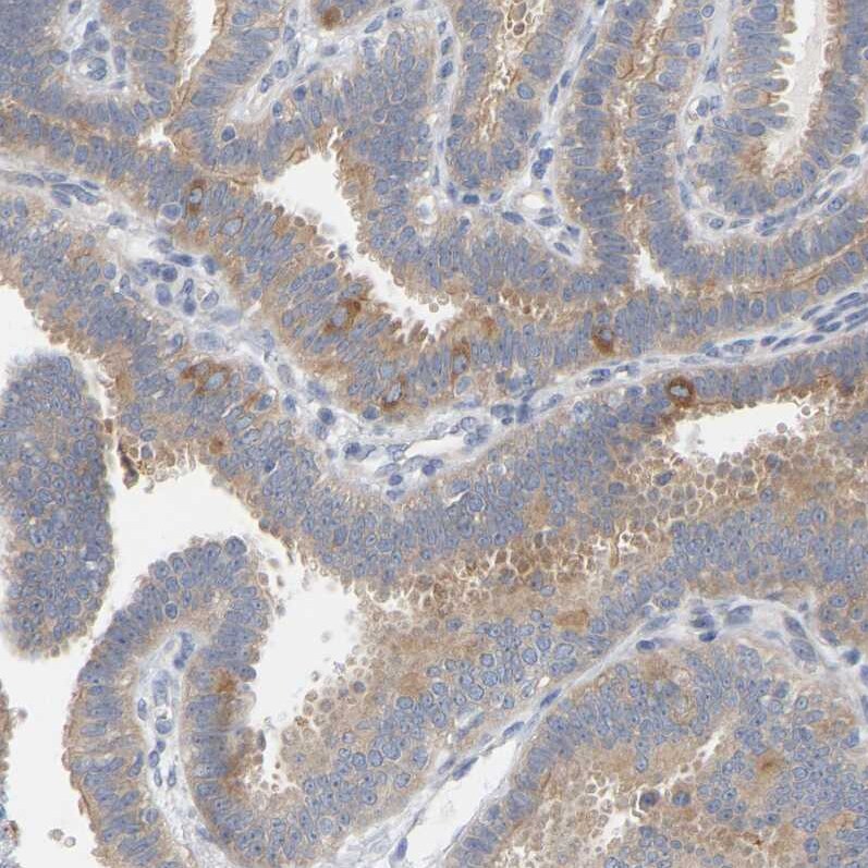 FAM188B Antibody - BSA Free Immunohistochemistry: FAM188B Antibody - BSA Free [NBP1-91239]