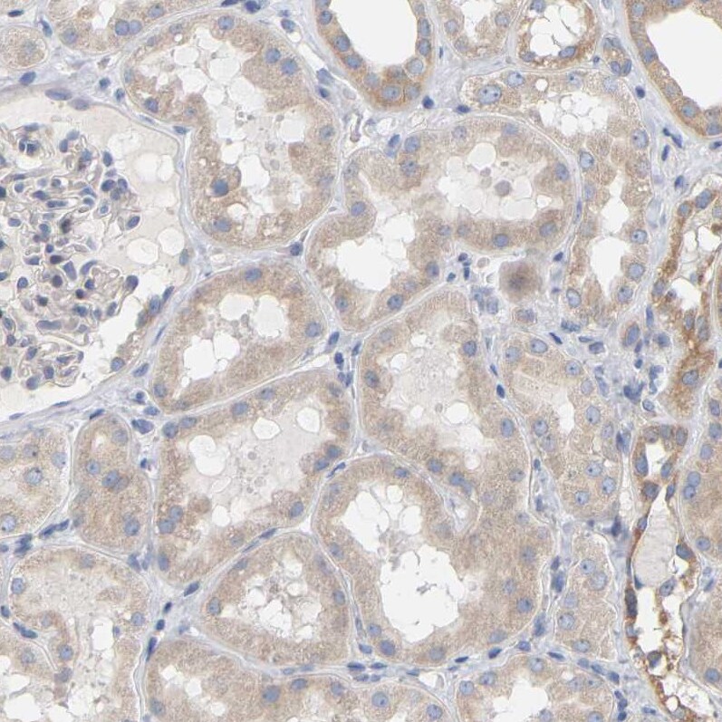 FAM188B Antibody - BSA Free Immunohistochemistry: FAM188B Antibody - BSA Free [NBP1-91239]