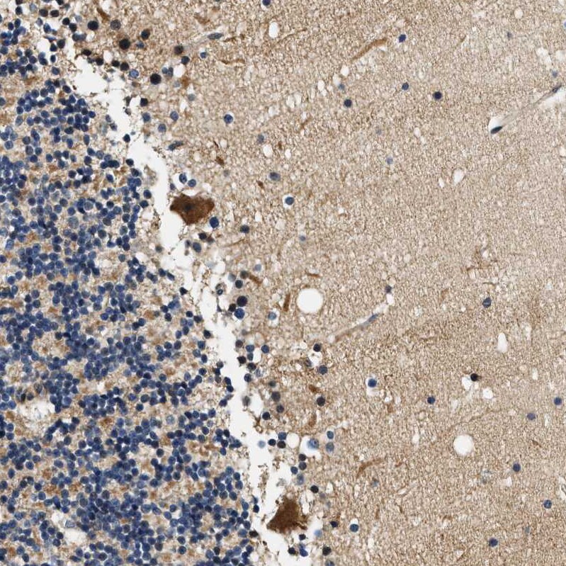 SAMD9 Antibody - BSA Free Immunohistochemistry: SAMD9 Antibody - BSA Free [NBP1-91245]
