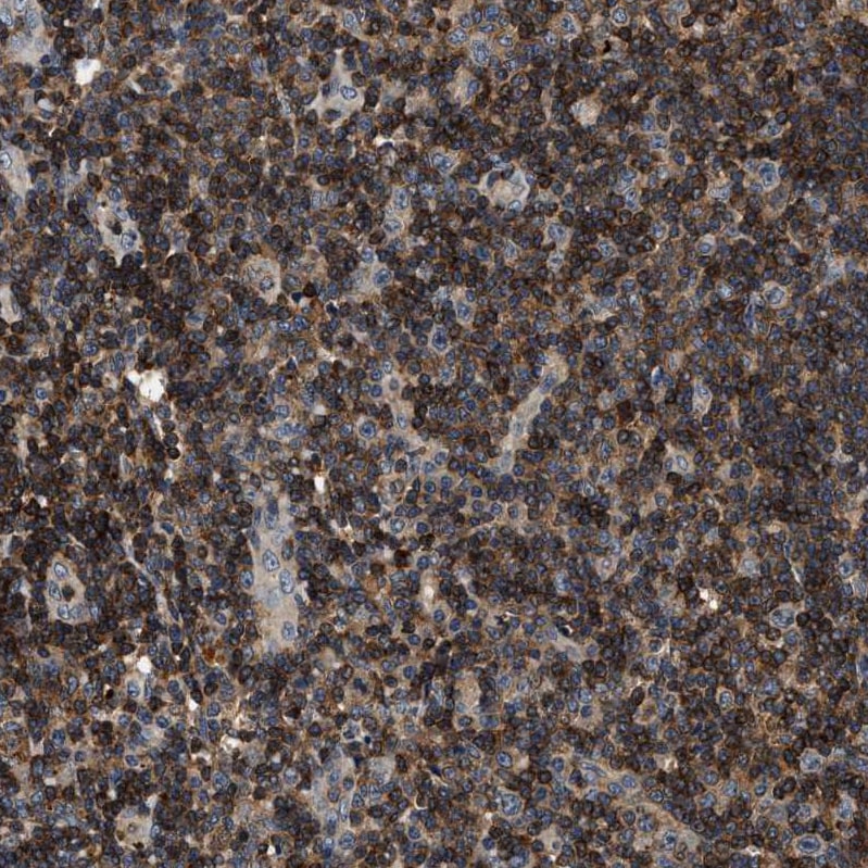 SAMD9 Antibody - BSA Free Immunohistochemistry: SAMD9 Antibody - BSA Free [NBP1-91245]