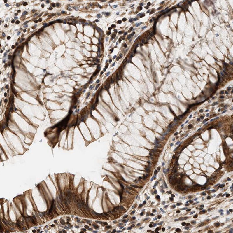 SAMD9 Antibody - BSA Free Immunohistochemistry: SAMD9 Antibody - BSA Free [NBP1-91245]