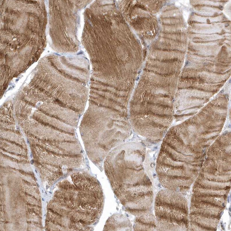ZC3H12D Antibody - BSA Free Immunohistochemistry: ZC3H12D Antibody - BSA Free [NBP1-91249]