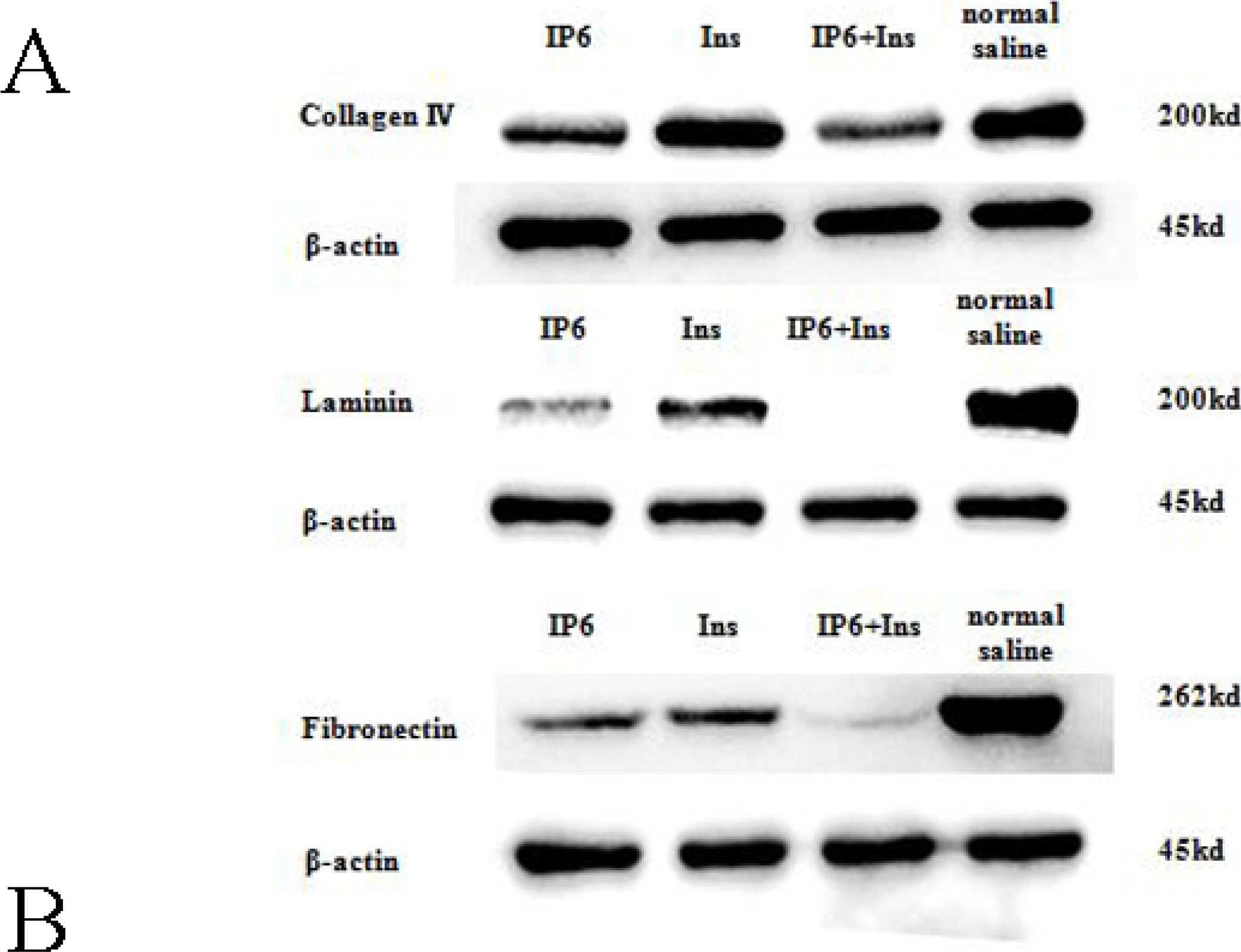 Fibronectin Antibody - BSA Free