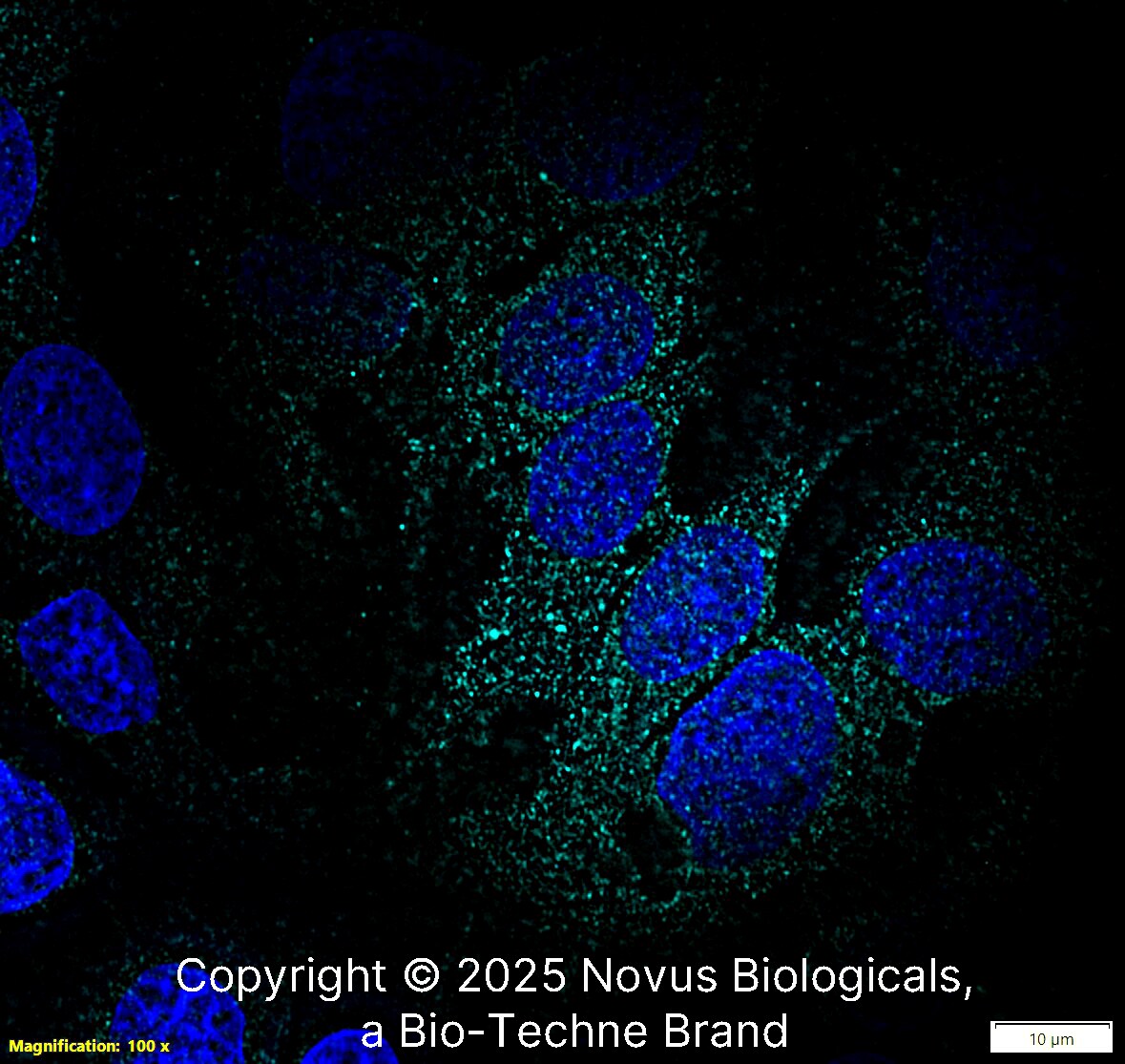 Fibronectin Antibody [Alexa Fluor® 647]