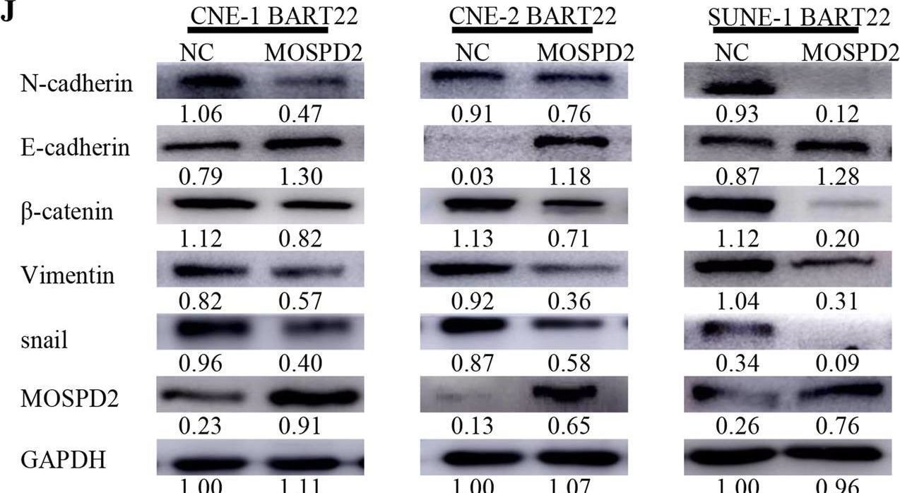 MOSPD2 Antibody - BSA Free
