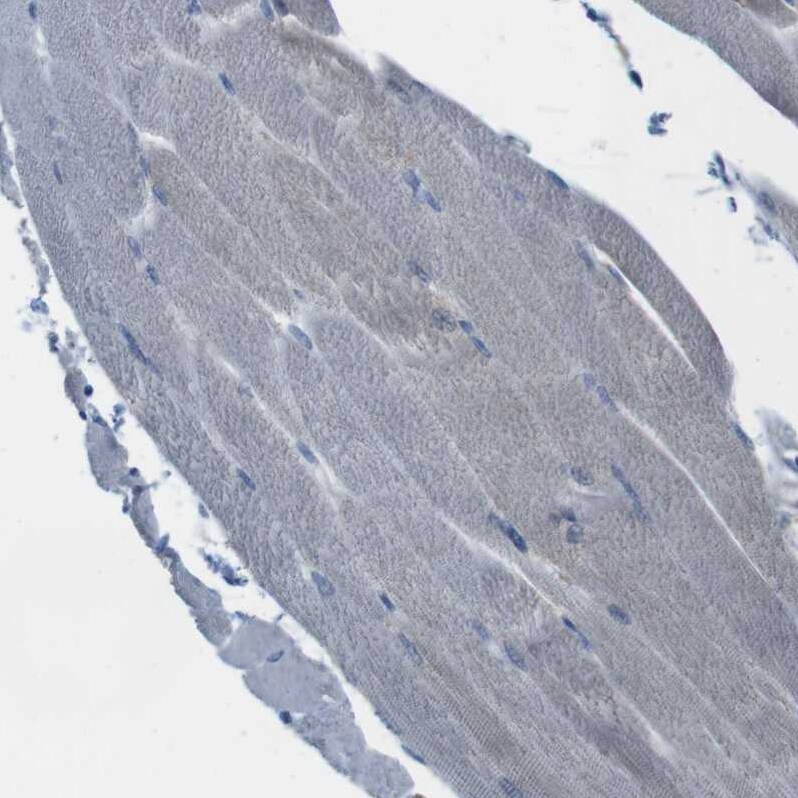 MARCH1 Antibody - BSA Free Immunohistochemistry-Paraffin: MARCH1 Antibody [NBP1-91637]