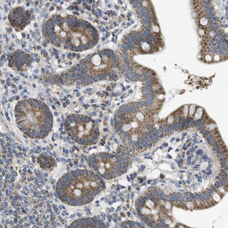 MARCH1 Antibody - BSA Free Immunohistochemistry-Paraffin: MARCH1 Antibody [NBP1-91637]