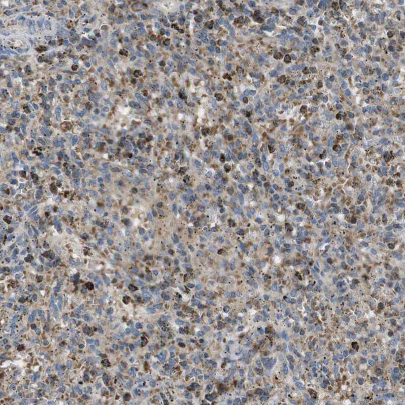 MARCH1 Antibody - BSA Free Immunohistochemistry-Paraffin: MARCH1 Antibody [NBP1-91637]
