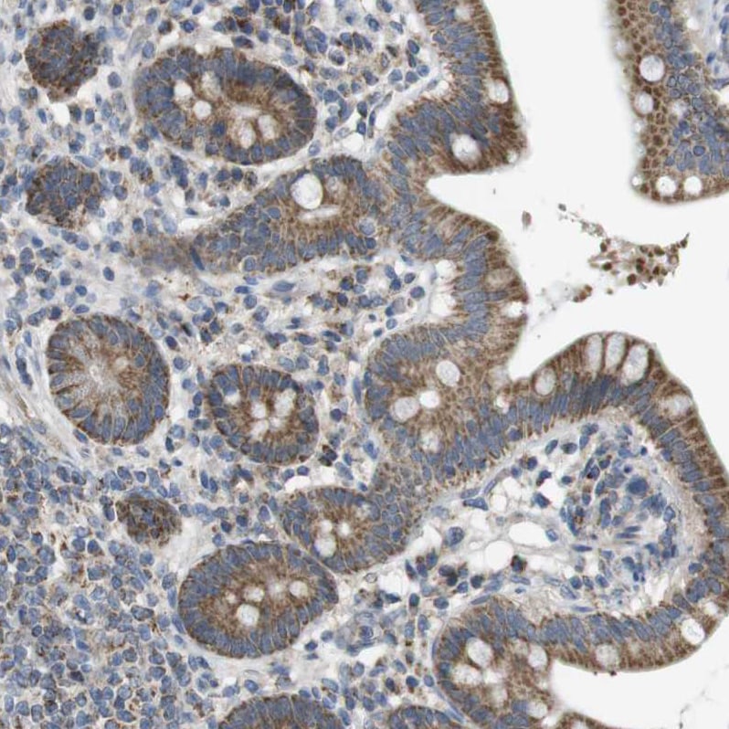 MARCH1 Antibody - BSA Free Immunohistochemistry: MARCH1 Antibody - BSA Free [NBP1-91637]