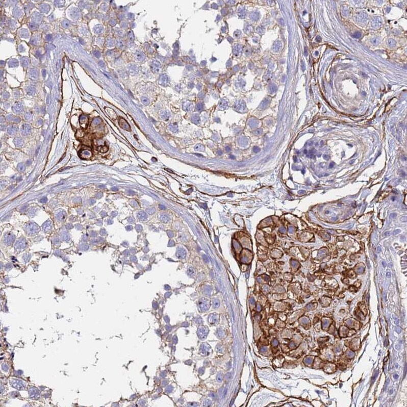 ABCA8 Antibody - BSA Free Immunohistochemistry: ABCA8 Antibody - BSA Free [NBP1-91641]