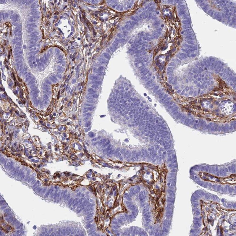 ABCA8 Antibody - BSA Free Immunohistochemistry: ABCA8 Antibody - BSA Free [NBP1-91641]