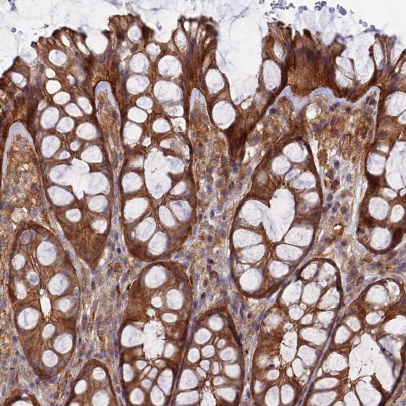ABHD1 Antibody - BSA Free Immunohistochemistry: ABHD1 Antibody - BSA Free [NBP1-91644]