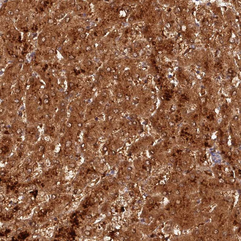 ACSM5 Antibody - BSA Free Immunohistochemistry: ACSM5 Antibody - BSA Free [NBP1-91646]