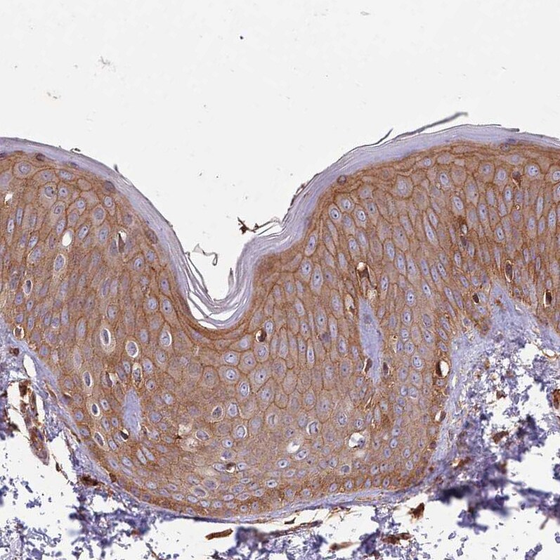 Activin RIIA Antibody - BSA Free Immunohistochemistry: Activin RIIA Antibody - BSA Free [NBP1-91647]