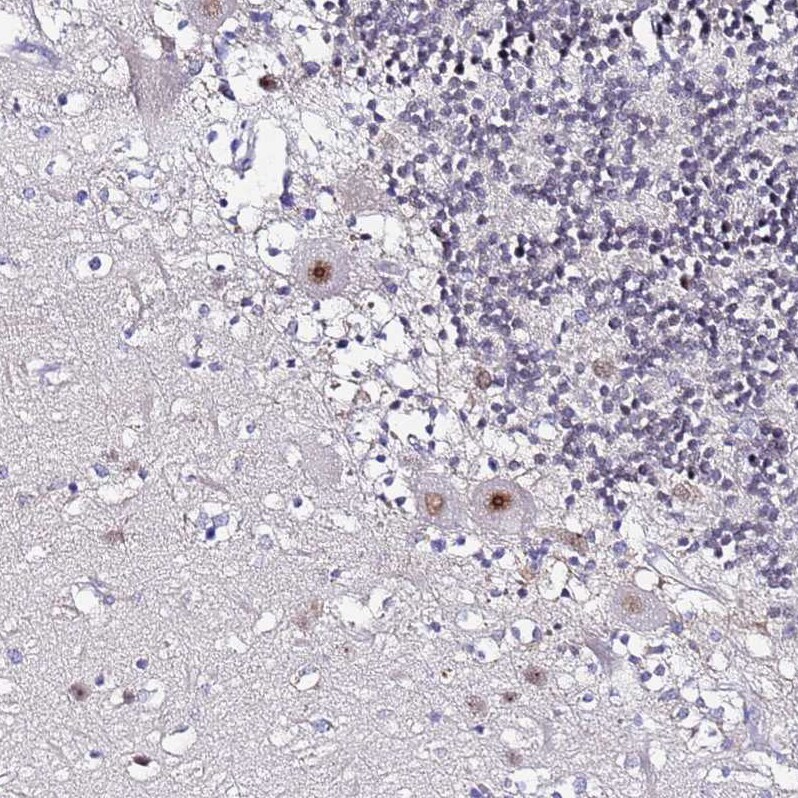 ACTL6B Antibody - BSA Free Immunohistochemistry: ACTL6B Antibody - BSA Free [NBP1-91648]