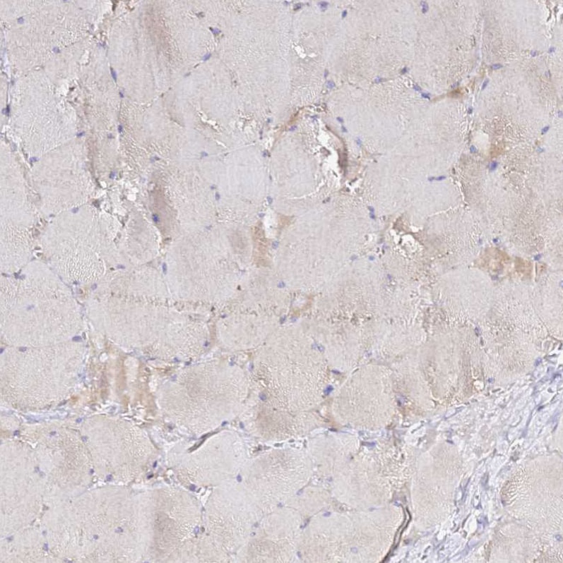 ADPGK Antibody - BSA Free Immunohistochemistry: ADPGK Antibody - BSA Free [NBP1-91653]