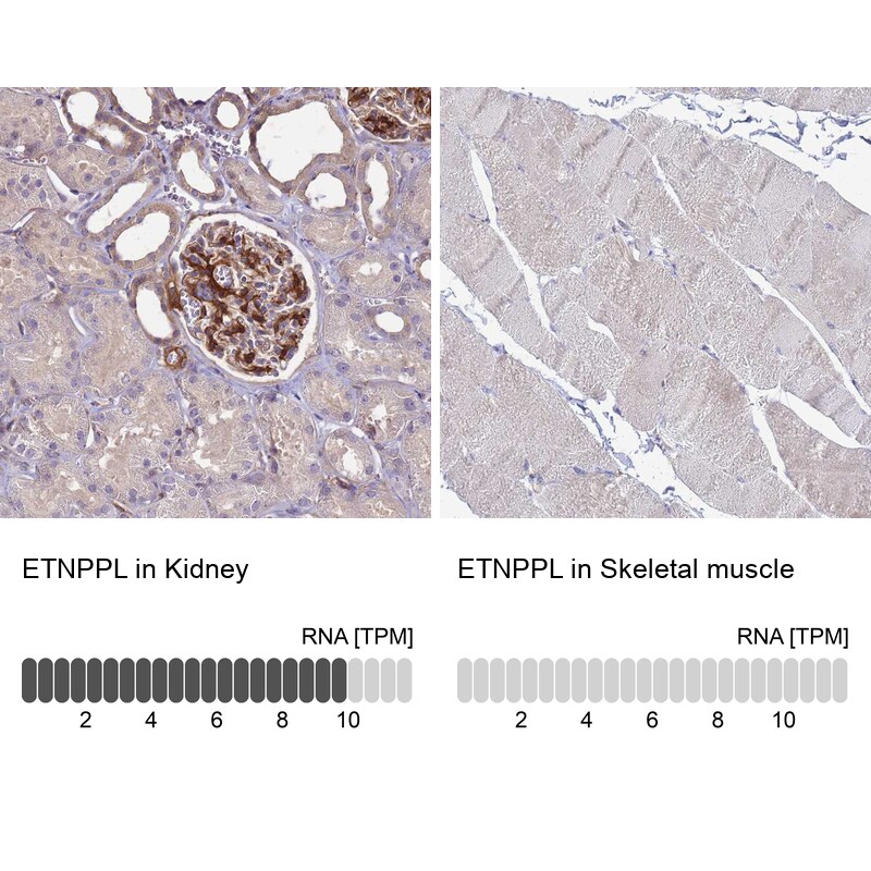 AGXT2L1 Antibody - BSA Free Immunohistochemistry: AGXT2L1 Antibody - BSA Free [NBP1-91655]