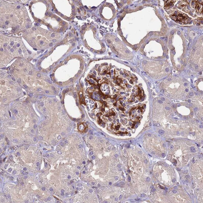 AGXT2L1 Antibody - BSA Free Immunohistochemistry: AGXT2L1 Antibody - BSA Free [NBP1-91655]