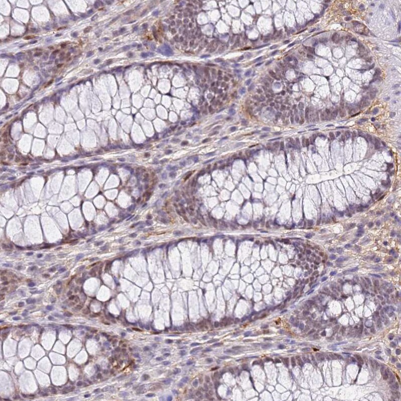 ALDH1A3 Antibody - BSA Free Immunohistochemistry: ALDH1A3 Antibody - BSA Free [NBP1-91657]