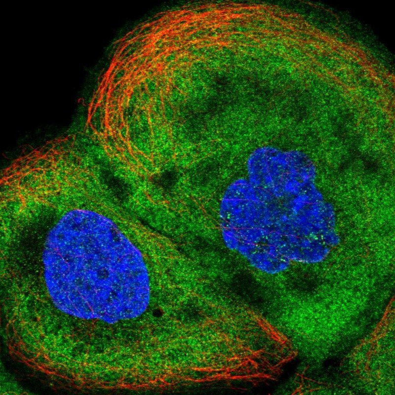 ALDH1A3 Antibody - BSA Free Immunocytochemistry/ Immunofluorescence: ALDH1A3 Antibody - BSA Free [NBP1-91657]
