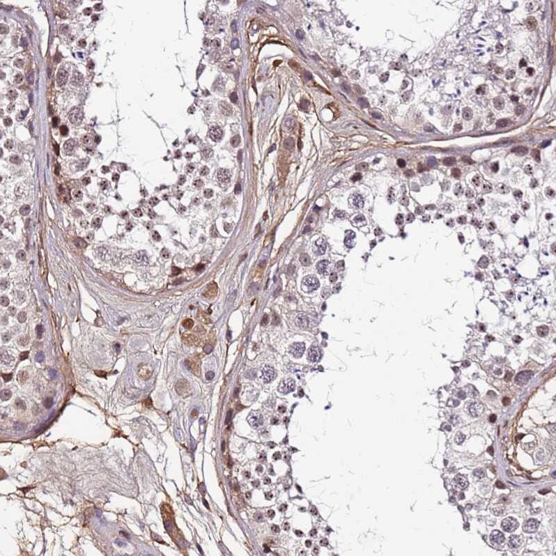 ALDH1A3 Antibody - BSA Free Immunohistochemistry: ALDH1A3 Antibody - BSA Free [NBP1-91657]