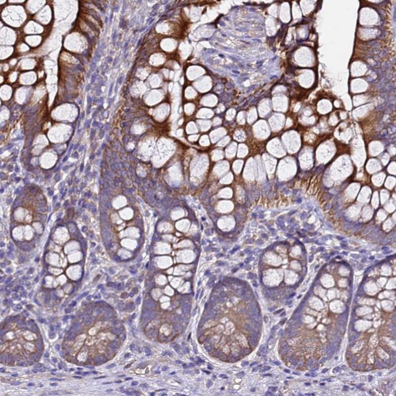 ALG3 Antibody - BSA Free Immunohistochemistry: ALG3 Antibody - BSA Free [NBP1-91658]