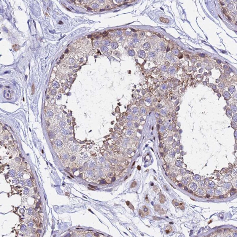 ALG3 Antibody - BSA Free Immunohistochemistry: ALG3 Antibody - BSA Free [NBP1-91658]