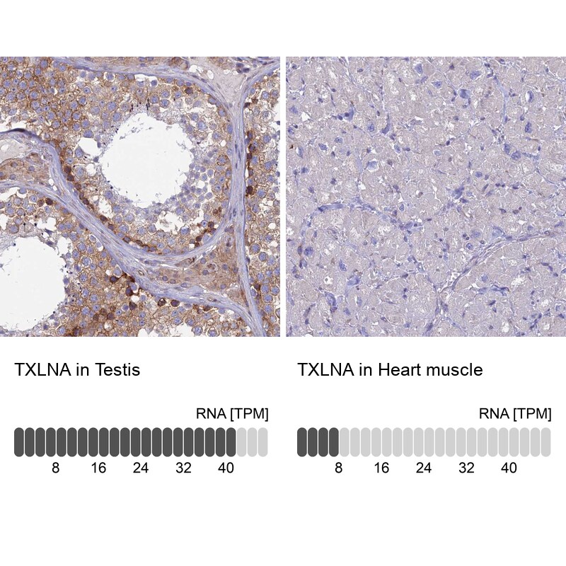 alpha-Taxilin Antibody - BSA Free Immunohistochemistry: alpha-Taxilin Antibody - BSA Free [NBP1-91662]