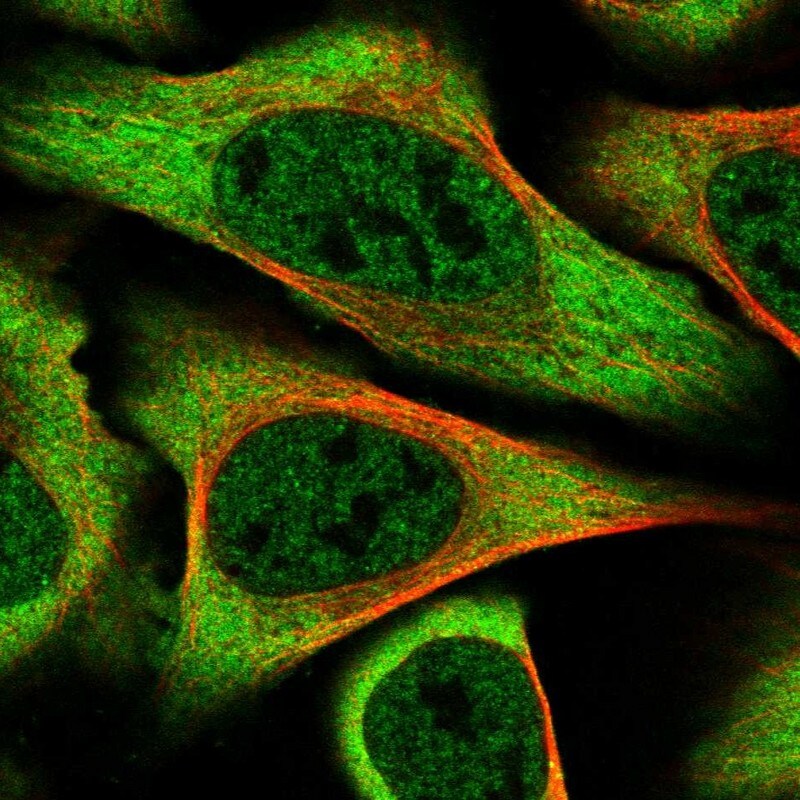 alpha-Taxilin Antibody - BSA Free Immunocytochemistry/ Immunofluorescence: alpha-Taxilin Antibody - BSA Free [NBP1-91662]