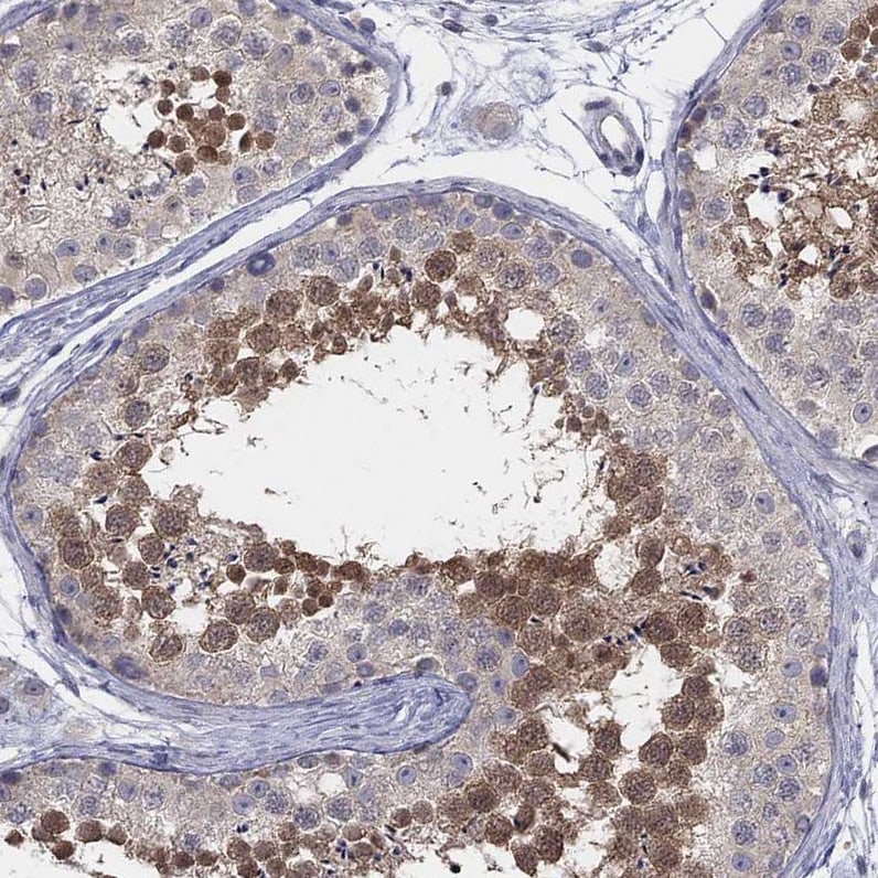 AMN1 Antibody - BSA Free Immunohistochemistry: AMN1 Antibody - BSA Free [NBP1-91663]