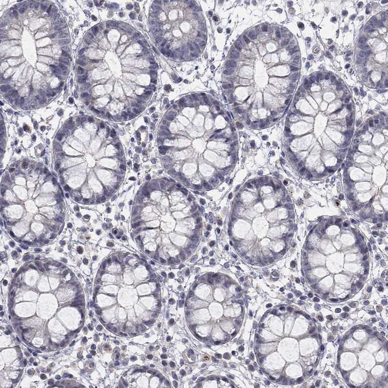 AMN1 Antibody - BSA Free Immunohistochemistry: AMN1 Antibody - BSA Free [NBP1-91663]