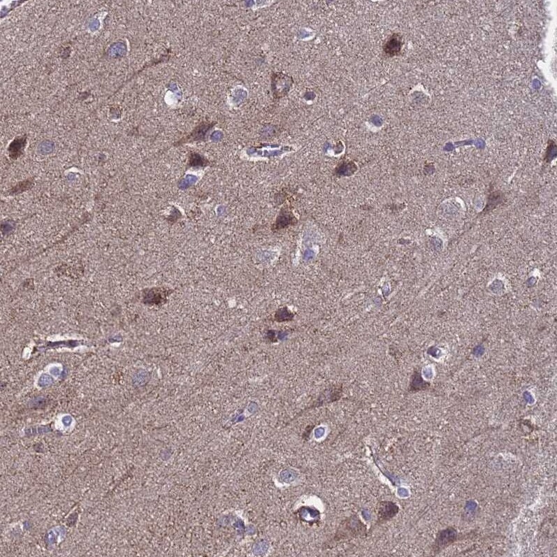 ANAPC13 Antibody - BSA Free Immunohistochemistry: ANAPC13 Antibody - BSA Free [NBP1-91664]