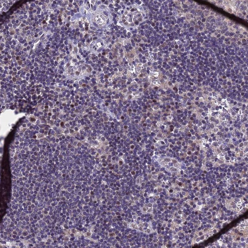 ANAPC13 Antibody - BSA Free Immunohistochemistry: ANAPC13 Antibody - BSA Free [NBP1-91664]