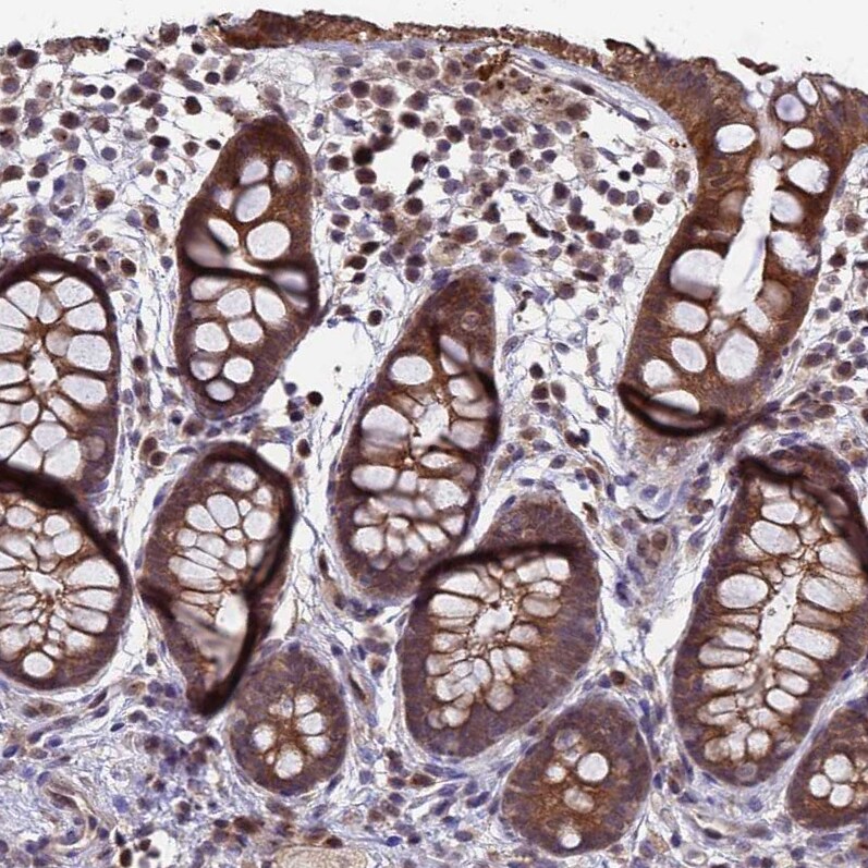 ANAPC13 Antibody - BSA Free Immunohistochemistry: ANAPC13 Antibody - BSA Free [NBP1-91664]