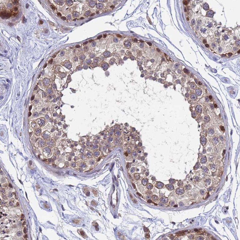 ANAPC13 Antibody - BSA Free Immunohistochemistry: ANAPC13 Antibody - BSA Free [NBP1-91664]