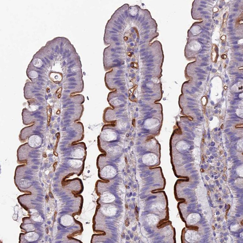 ACE/CD143 Antibody - BSA Free Immunohistochemistry-Paraffin: ACE/CD143 Antibody [NBP1-91666]