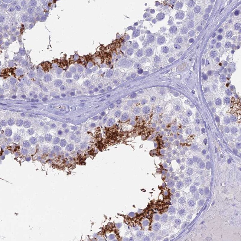 ACE/CD143 Antibody - BSA Free Immunohistochemistry-Paraffin: ACE/CD143 Antibody [NBP1-91666]