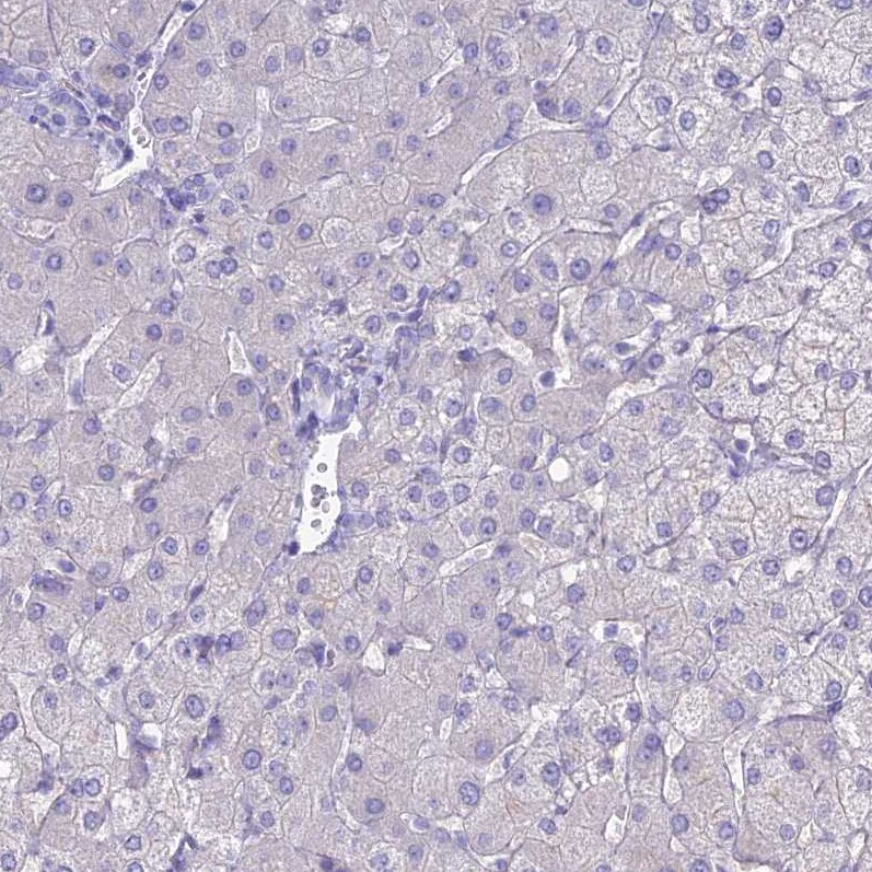 ACE/CD143 Antibody - BSA Free Immunohistochemistry-Paraffin: ACE/CD143 Antibody [NBP1-91666]
