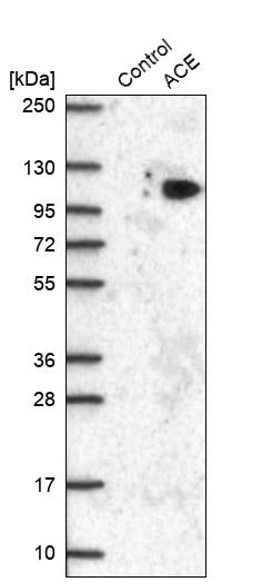 ACE/CD143 Antibody - BSA Free Western Blot: ACE/CD143 Antibody - BSA Free [NBP1-91666]
