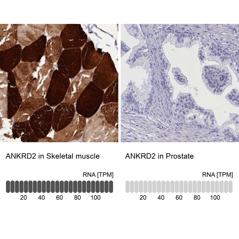 ANKRD2 Antibody - BSA Free Immunohistochemistry-Paraffin: ANKRD2 Antibody [NBP1-91669]