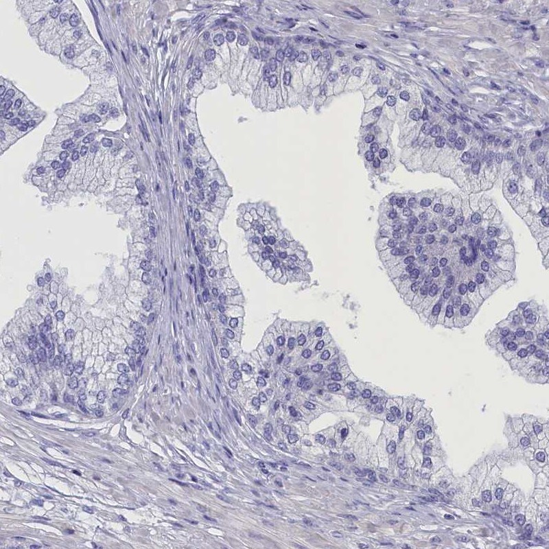ANKRD2 Antibody - BSA Free Immunohistochemistry-Paraffin: ANKRD2 Antibody [NBP1-91669]