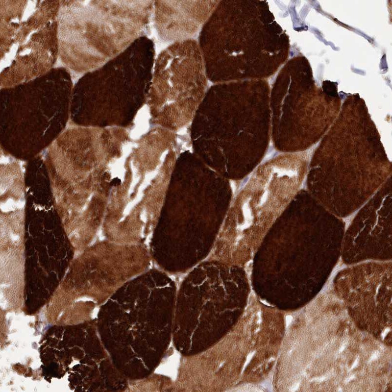 ANKRD2 Antibody - BSA Free Immunohistochemistry-Paraffin: ANKRD2 Antibody [NBP1-91669]