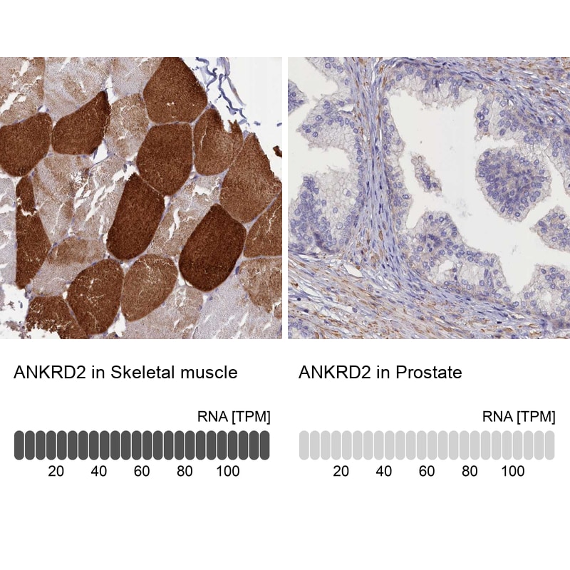 ANKRD2 Antibody - BSA Free Immunohistochemistry-Paraffin: ANKRD2 Antibody [NBP1-91670]