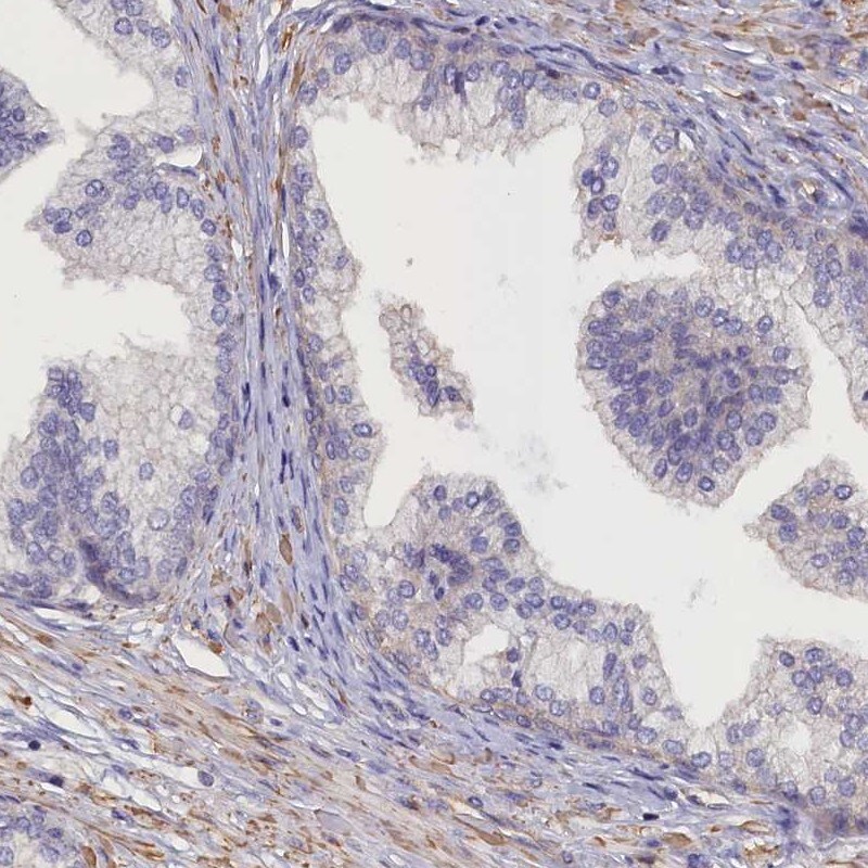 ANKRD2 Antibody - BSA Free Immunohistochemistry-Paraffin: ANKRD2 Antibody [NBP1-91670]