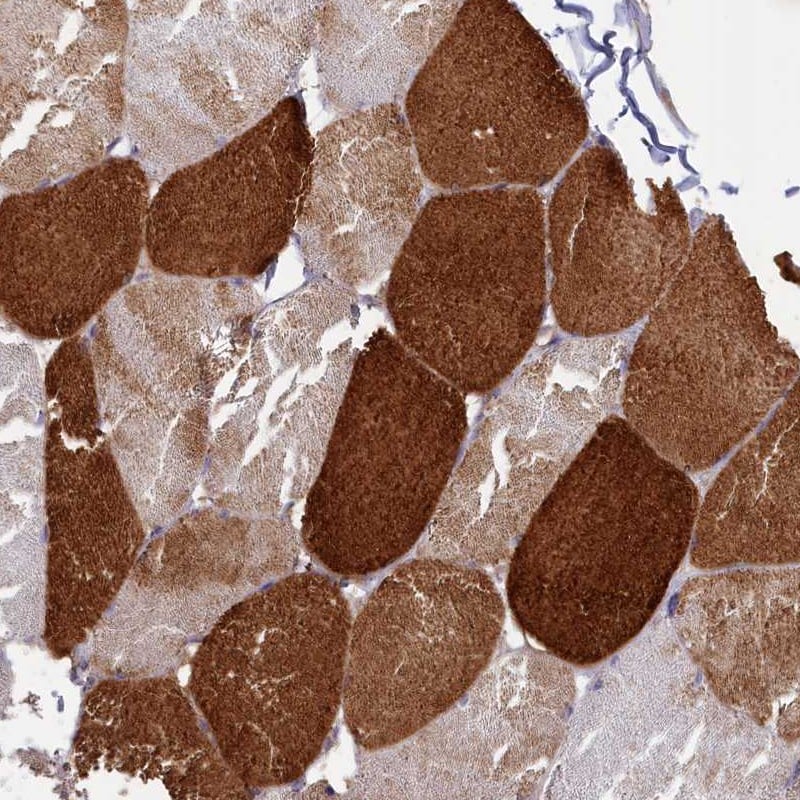 ANKRD2 Antibody - BSA Free Immunohistochemistry-Paraffin: ANKRD2 Antibody [NBP1-91670]